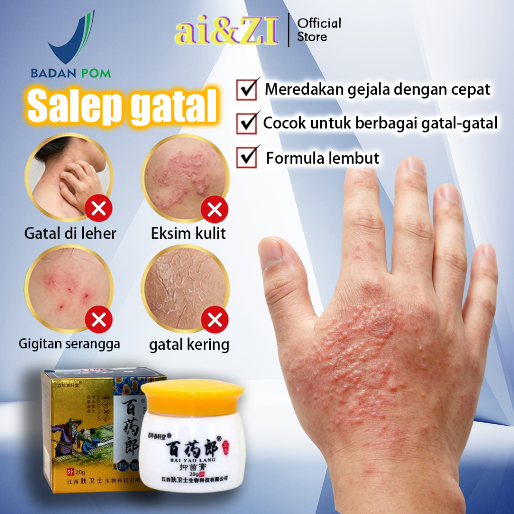 AI&ZI salep china gatal paling ampuh Salep Eksim Kering dan Gatal Salep bayi obat eksim psoriasis cr