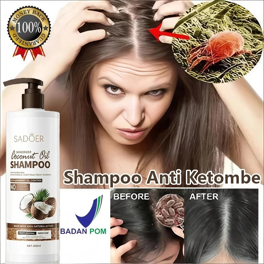 Kelapa Shampoo Anti Ketombe Sampo Ketombe Sampo Anti Ketombe Obat Ketombe Ampuh Shampo Ketombe Shamp