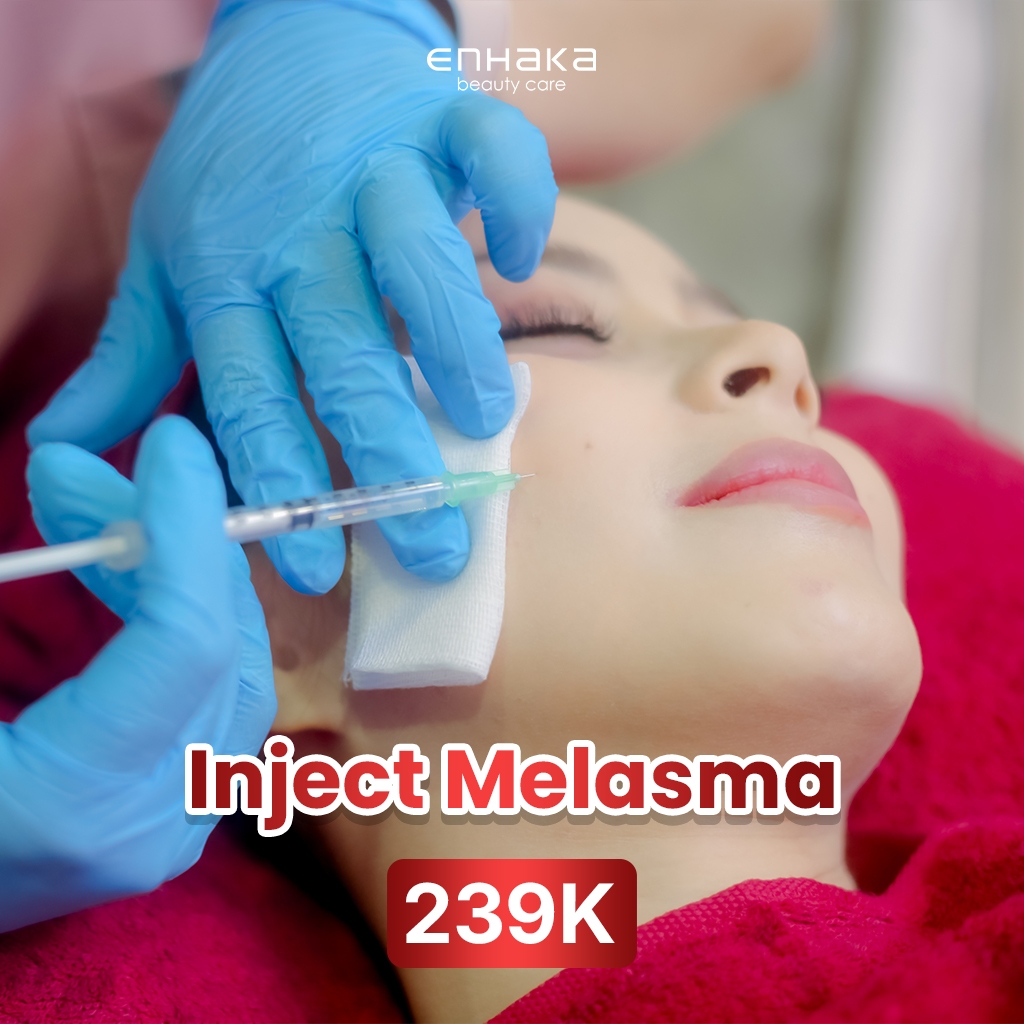 Voucher Treatment Injeksi Penghilang Melasma - Enhaka Bandung (Reguler)