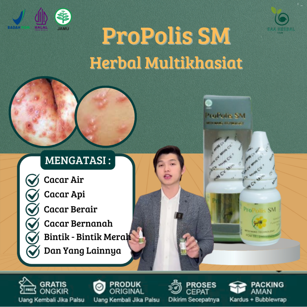 Obat Cacar Air, Gatal-Gatal, Kaligata, Cacar Api, Bintik Merah, Cacar Berair, Alergi Bopeng Bekas Ca