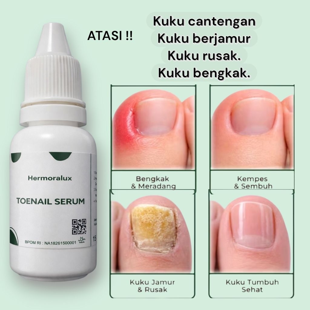 OBAT KUKU CANTENGAN JAMUR KUKU RUSAK BPOM HERMORALUX