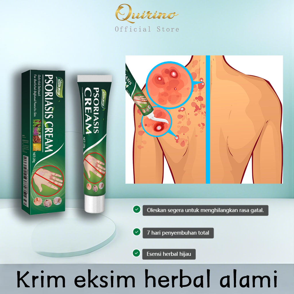 Quirino Salep Gatal Paling Ampuh Anti Jamur Gatal Gatal Seluruh Badan Obat Gatal Kulit Salep Eksim G