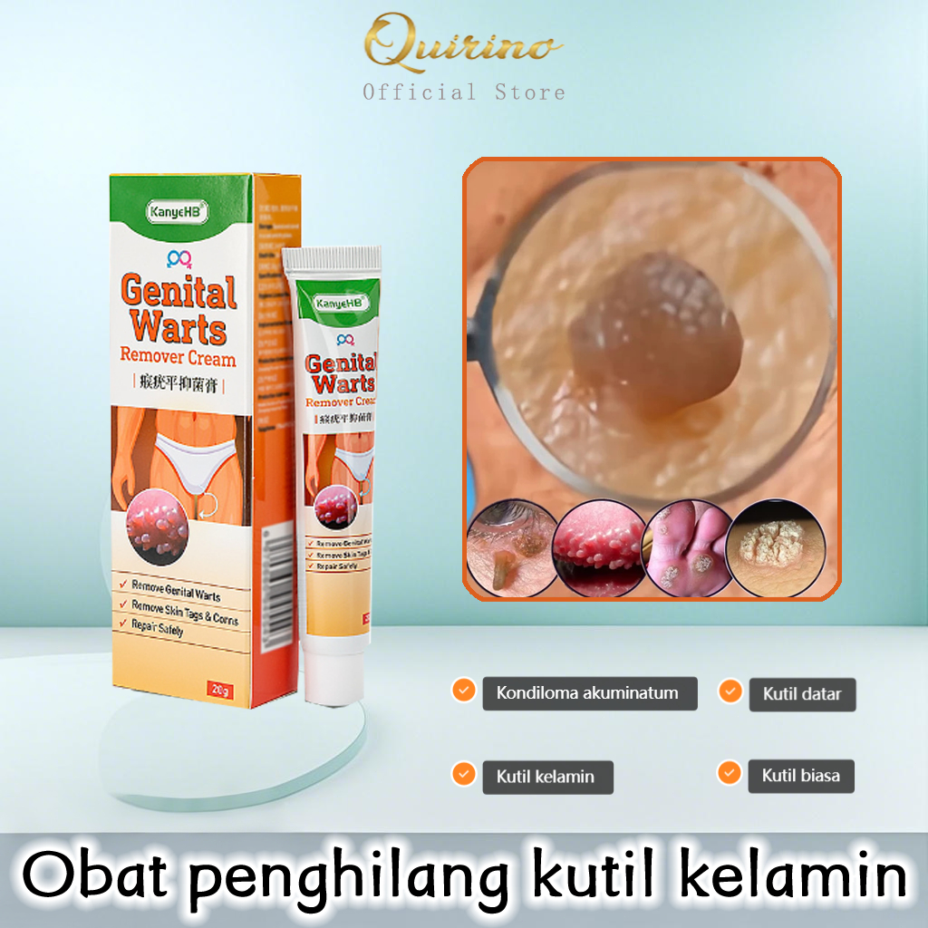 Quirino Obat kutil kelamin Penghilang Kutil Kelamin Obat Kutil Kelamin HPV Penghilang kutil dan tahi