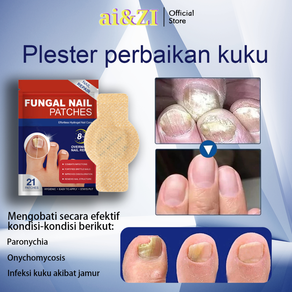 AI&ZI Plester Perawatan Kuku 21pcs/kotak obat jamur kuku obat kuku rusak obt kuku jamur dan rusak or