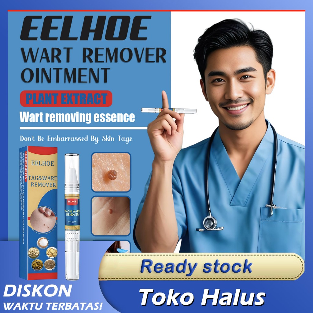 EELHOE Wart Remover Pen Cream Salep Badan Tubuh Wajah Tahi Lalat | Herbal Alami Natural