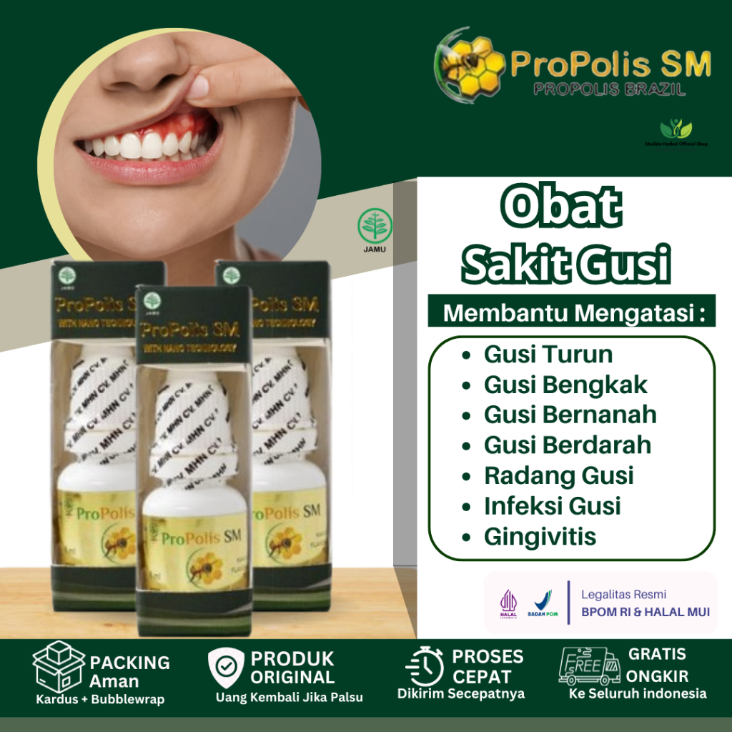 Propolis SM Obat Gusi Turun Sakit Bengkak Bernanah Berdarah Radang Gusi Gingivitis Infeksi Gusi Anak