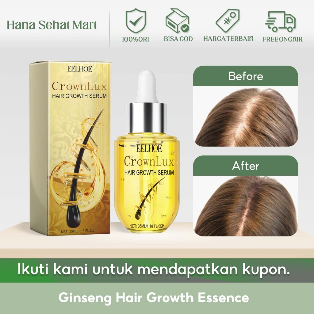 EELHOE Ginseng Hair Growth Essence 35ml Essensi Penumbuh Rambut Ginseng Extra Ginseng Asli Tonic Pen
