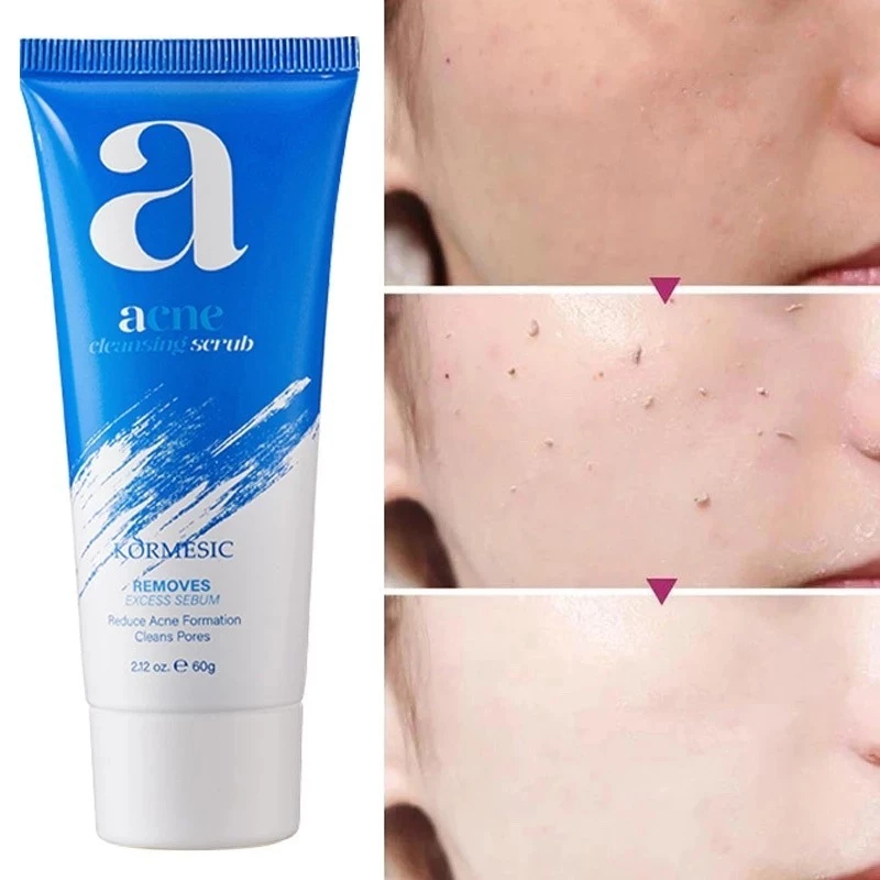 sabun cuci muka jerawat sabun cuci muka acnes sabun cuci muka clean and clear sabun muka clean and c