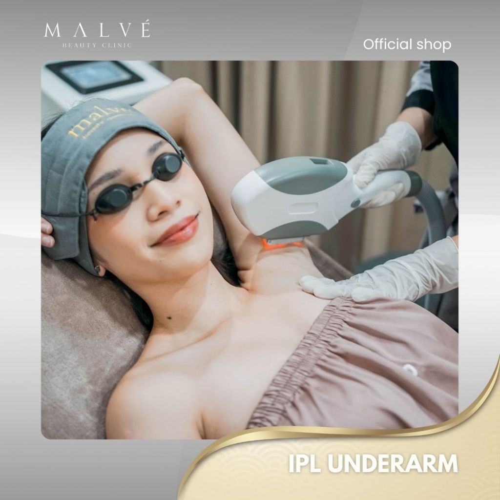 Malve IPL UNDERARM Treatment