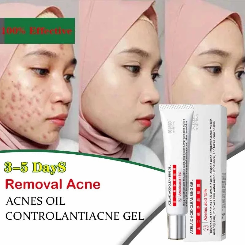 Obat Jerawat Paling Ampuh 15g Gel Penghilang Jerawat dan Bekas Jerawat Hitam Totol Jerawat Acne Spot
