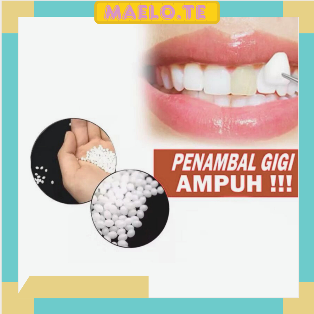 Penambal gigi berlubang 50 butir/100 butir | Tempooth | gigi palsu