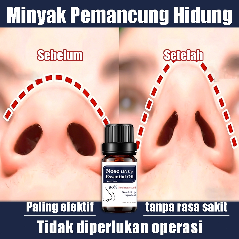 Minyak Esensial Pemancung Hidung Lift Up Original Meratakan Hidung Membuat Hidung Lebih Mancung Alam