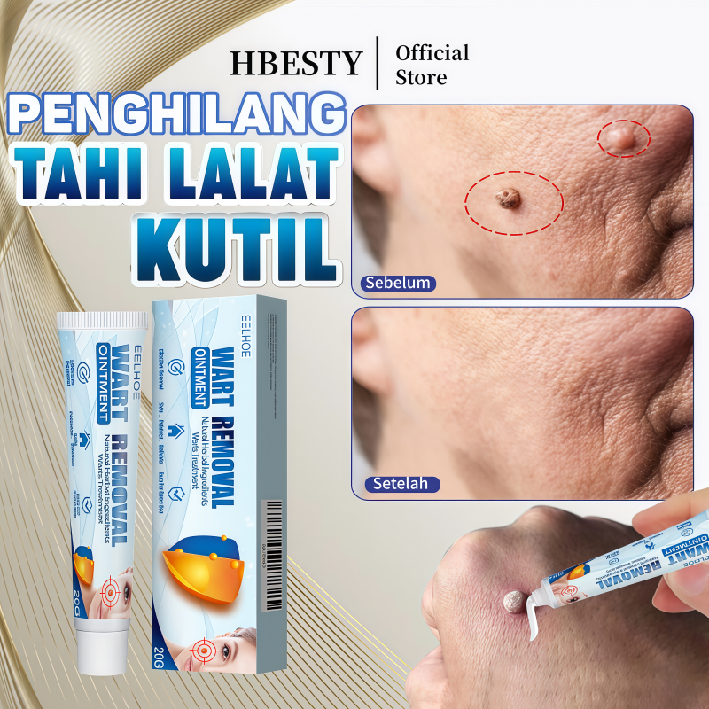 HBESTY Penghilang kutil dan tahi lalat Skin tag remover Krim penghilang kutil di wajah Kutil Remover