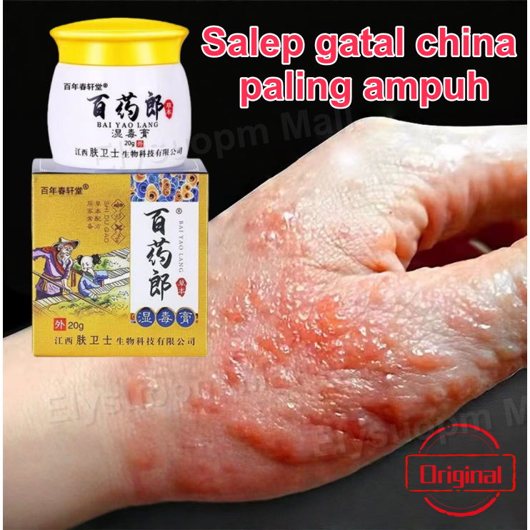 Salep gatal china paling ampuh Salep Gatal Selangkangan Obat Jamur Kulit Psoriasis Cream Obat Eksim 