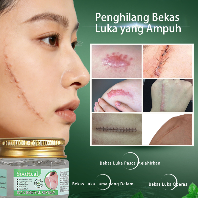 salep penghilang bekas luka, bekas luka, 15g,salep bekas luka,bio herbal penghilang bekas luka,pengh