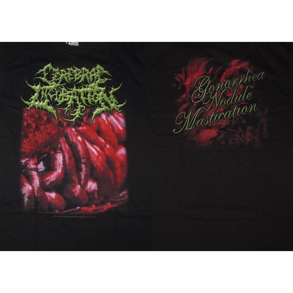 TS – CEREBRAL INCUBATION – Gonorrhea Nodule Mastication