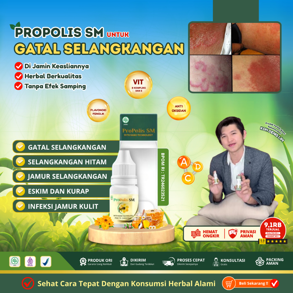 Obat Selangkangan Hitam dan Gatal, Obat Gatal/Kurap Selangkangan,Obat Lecet Selangkangan Eksim Jamur