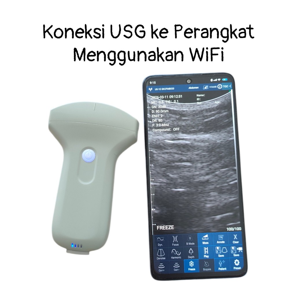 well -usg portable-Alat-alat bidan tipe convex