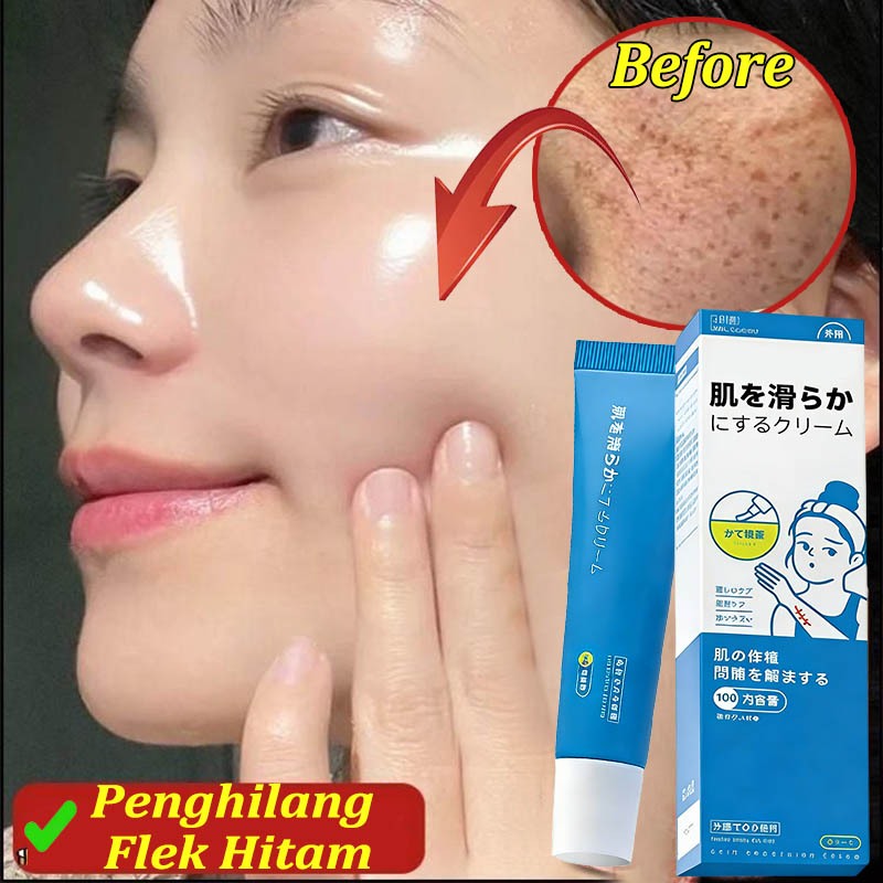 Krim Penghilang Flek Hitam Membandel Gel Penenang Kulit Menghilangkan Flek Hitam Di Wajah Pudar Flek