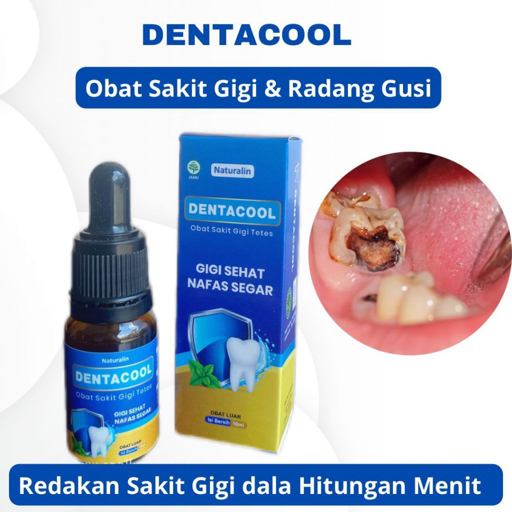 DENTACOOL Obat Sakit Gigi Ampuh Obat Sakit Gigi Tetes ORI 10 Ml