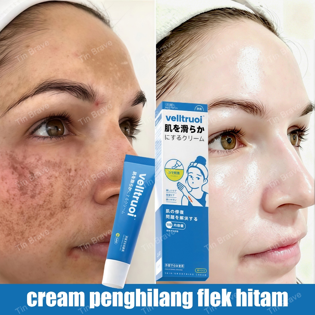 cream penghilang flek hitam cream flek hitam membandel salep flek hitam di wajah melasma cream white