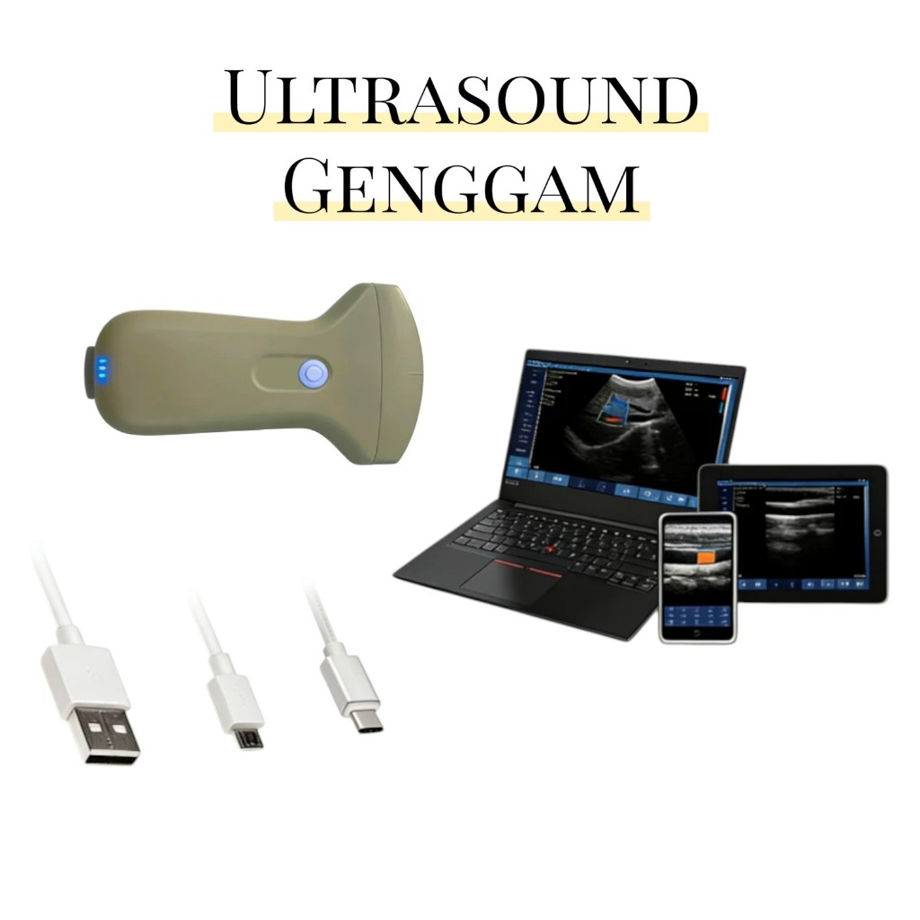 sonostar -usg portable-Alat-alat bidan