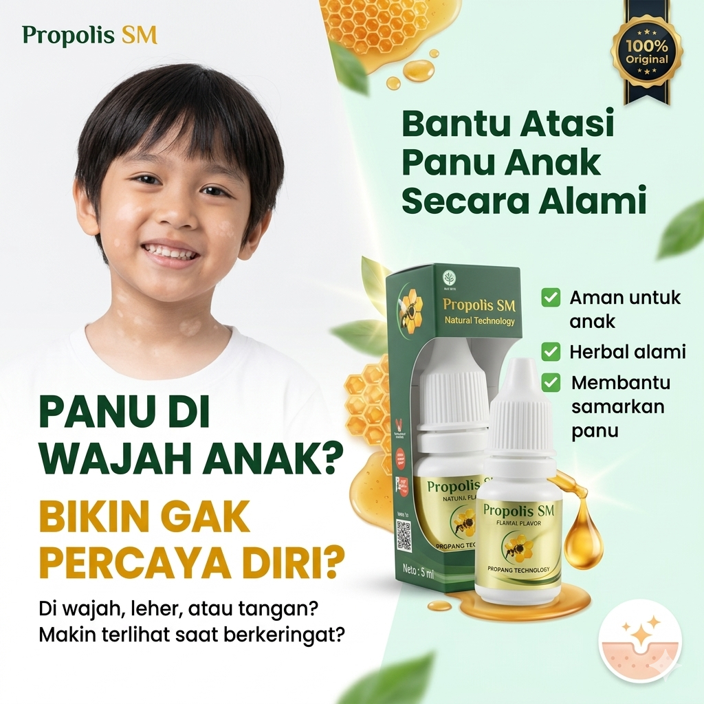 Obat Panuan Di Wajah Anak, Muka, Tangan, Leher Belakang, Obat Panu Anak Untuk Di Wajah,   Salep Peng