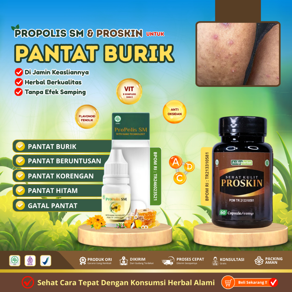 Obat Pantat Burik - Obat Pantat Gatal - Obat Pantat Bruntusan - Obat Pantat Jamur - Obat Gatal Selan