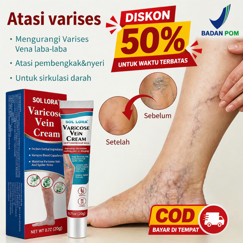 [BPOM]Salep Varises Ampuh - Obat Penghilang Urat Menonjol Kaki & Betis - Krim Vaskulitis Original Ha