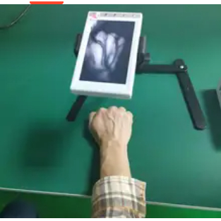 Accuracy Medical Vein Finder Detector Vein locator Medical Vein Imaging Device Veinpuncture Using Ve