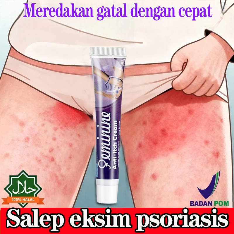 Salep gatal china paling ampuh salep gatal jamur selangkanga Krim Eksim Bayi dan Anak Obat gatal sel
