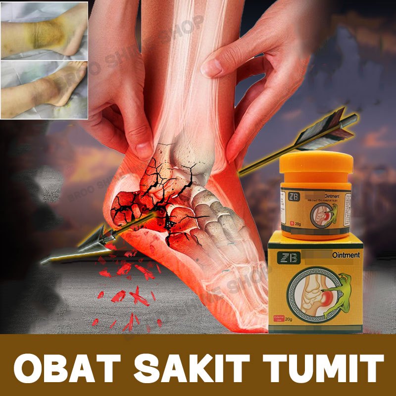 Obat Sakit Tumit Plantar Fasciitis Terapi Kaki Obat Nyeri Tumit  Salep Asam Urat Paling Ampuh Obat S