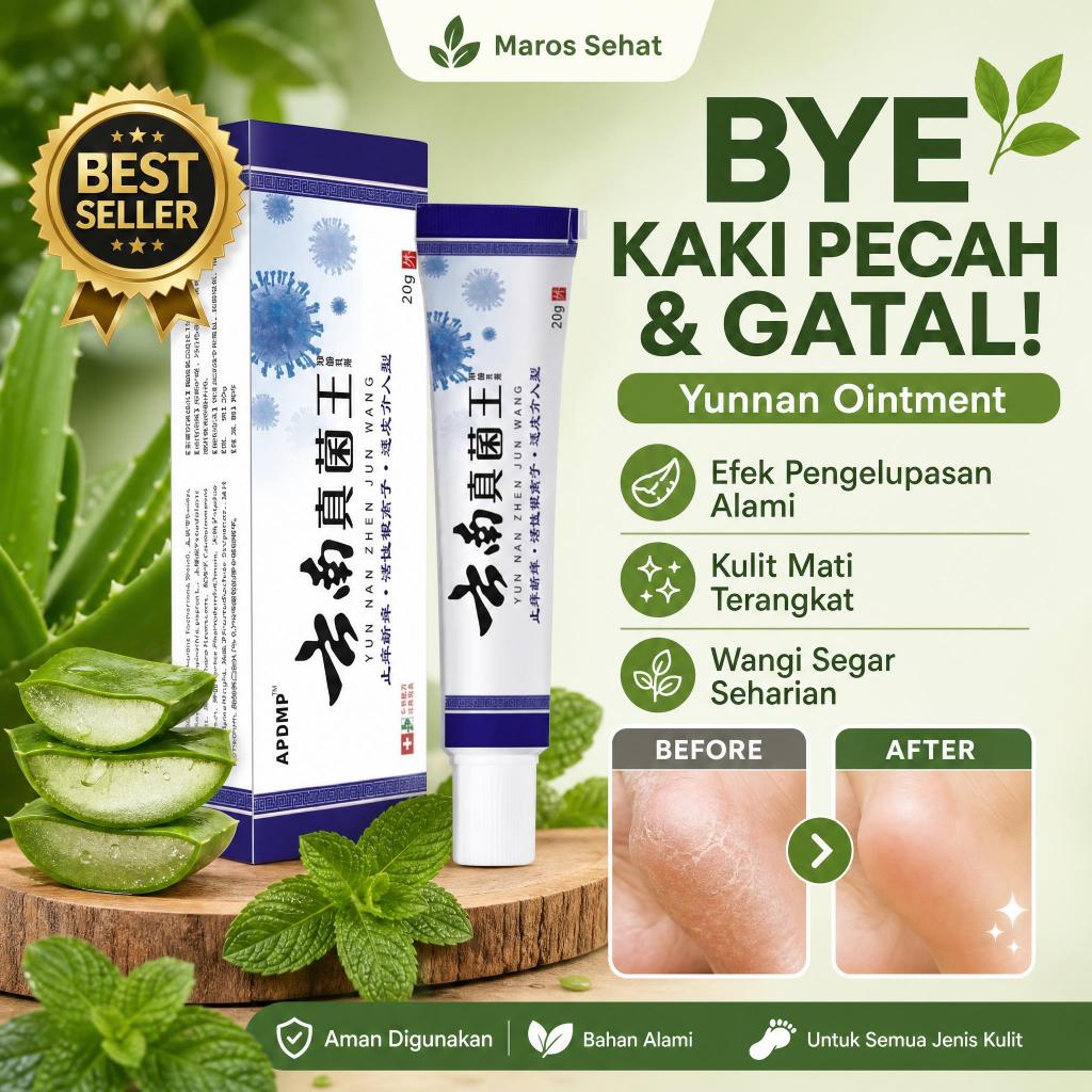 YUNNAN Obat Kaki Rayapan Dan Bau Salep Yunnan Obat Gatal Krim Pengelupas Kulit Mati Kaki Pembersih T