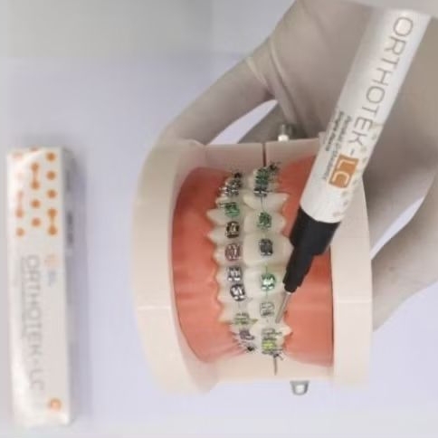 Dental Lem Ortho Behel Gigi Hexa Orthotek LC /Lem Behel / Perekat Behel Gigi