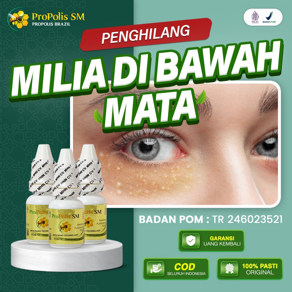 Obat Penghilang Milia Di Bawah Mata Milia Pada Wajah Milia Di Kelopak Mata Syringoma Propolis SM