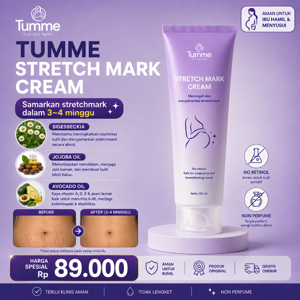 Stretchmark Cream Penghilang Stretch Mark Ibu Hamil & Pasca Melahirkan – Ampuh Samarkan Garis Putih 