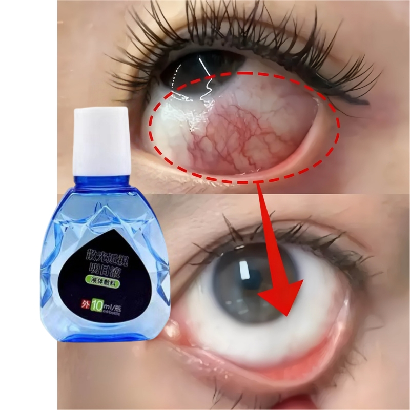 obat tetes mata no 1 di jepang tetes mata katarak mata katarak tanpa operasi obat katarak obat mata 