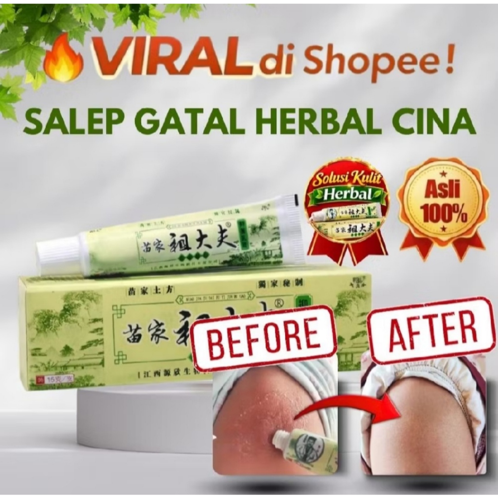 SALEP SUDAIFU KRIM UNTUK ANAK 2 THN & DEWASA ALERGI CACAR NANAH CACAR AIR CACAR ULAR GATAL SELAKANGA