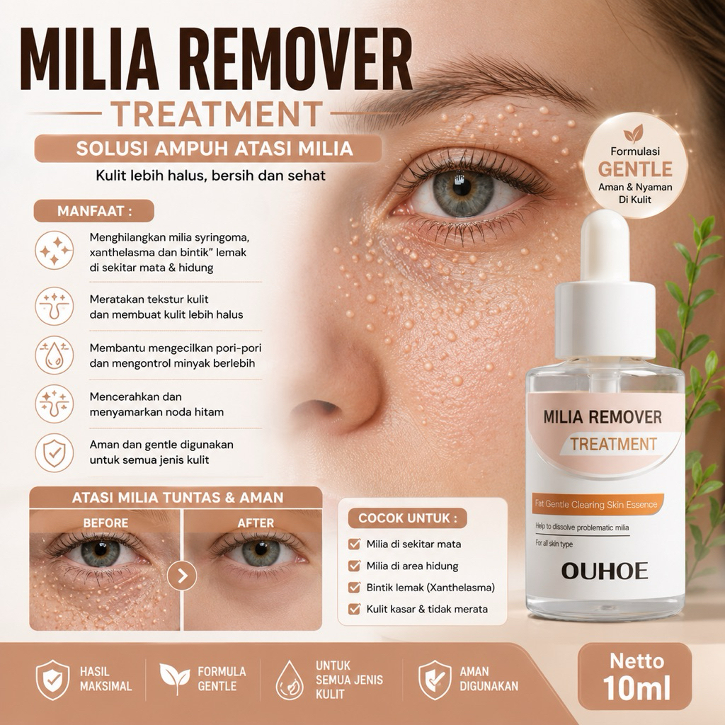 MILIA REMOVER Serum Penghilang Perontok Milia Bintik Putih Mata Ouhoe Milia Remover Treatment serum
