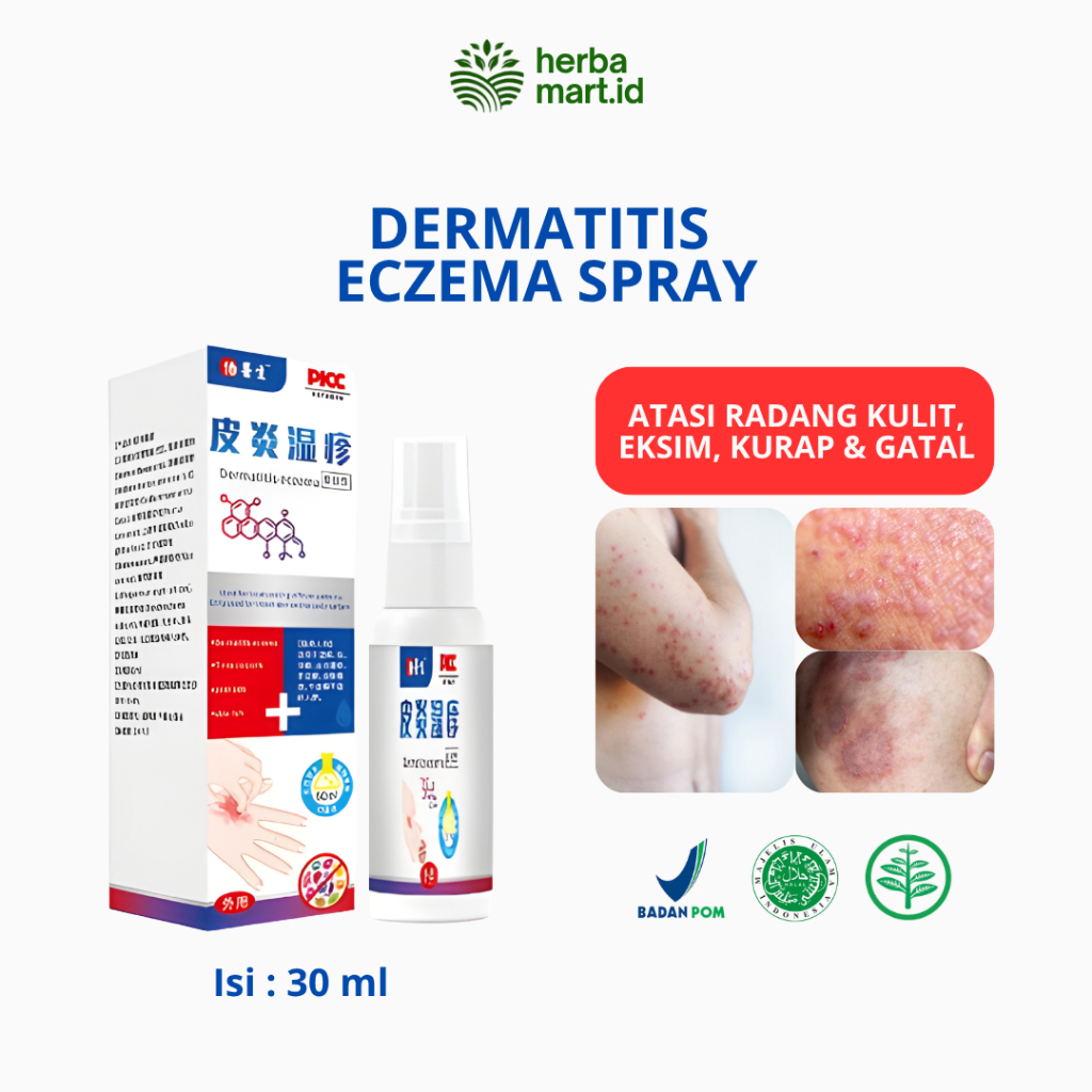 Dermatitis Eczema Spray Salep dermatitis seboroik salep eksim kering dan gatal