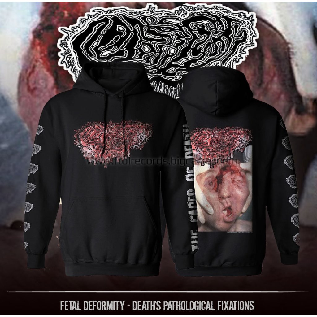 Original & Berlisensi Hoodie Fetal Deformity Goregrind
