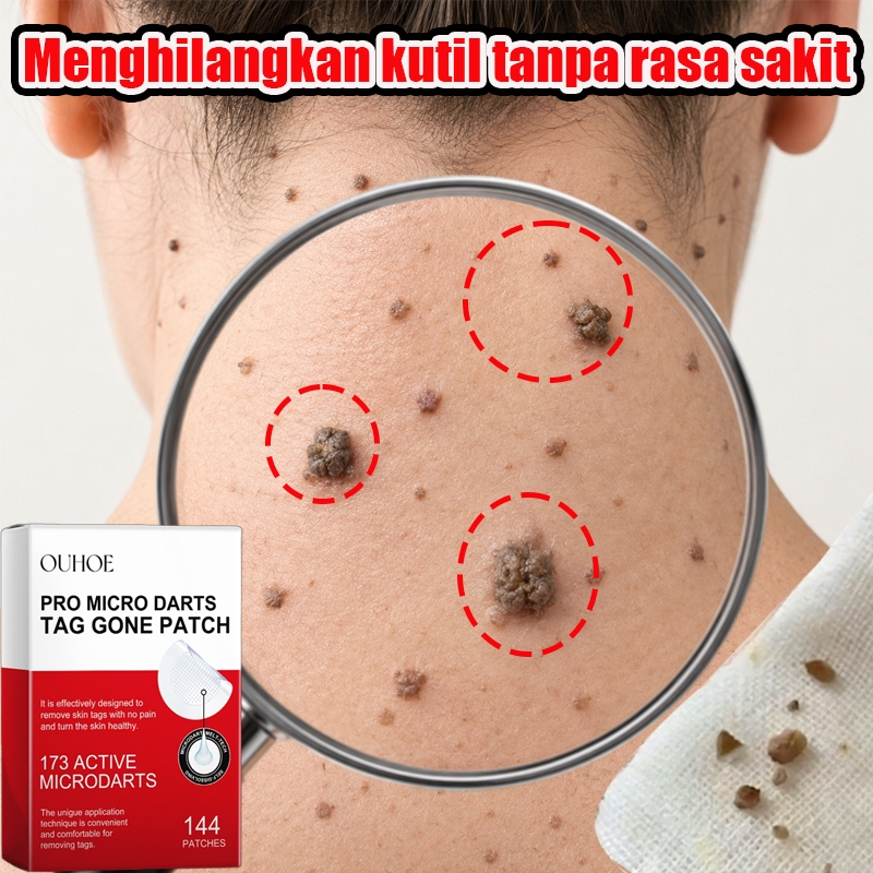 Stiker Penghilang Kutil Dan Tahi Skin Tag Patch 144pcs Lalat Penghilang Kutil Di Leher Penghilang Ta