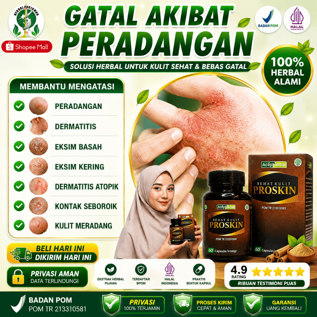 Obat Herbal Gatal Akibat Peradangan, Dermatitis, Eksim, Dermatitis Atopik, Seboroik, Kulit Meradang 