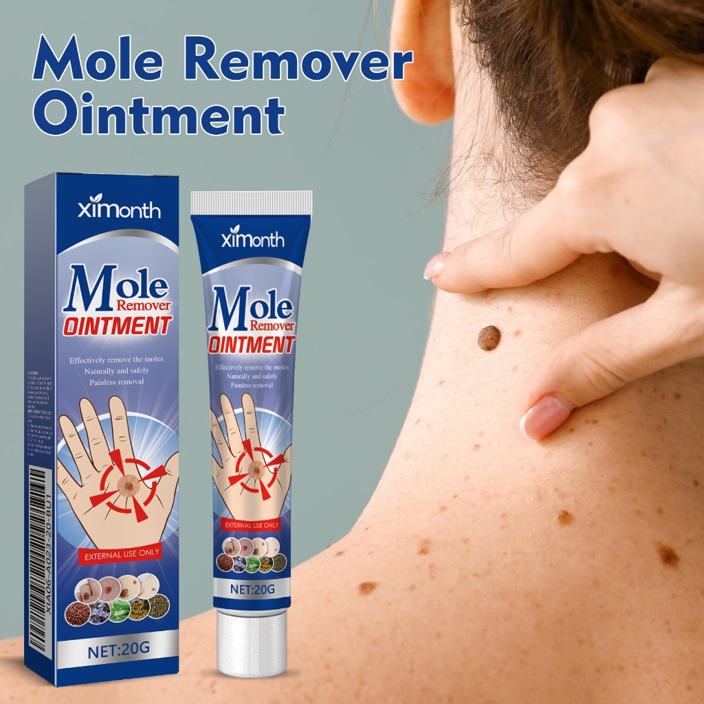 Ximonth Mole Remover Ointment 20g Herbal Alami Krim Penghilang Kutil Tanpa Rasa Sakit Perawatan Kuli