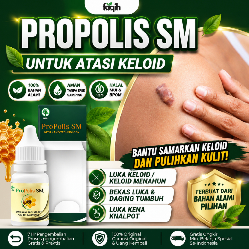 Propolis SM Obati Keloid Luka Kenalpot Bekas Luka Daging Tumbuh Keloid Menahun 100% Original
