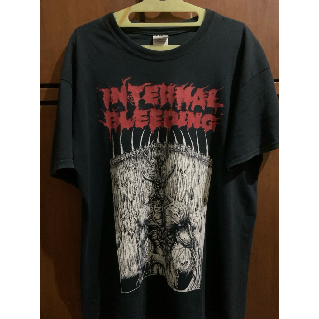 internal bleeding