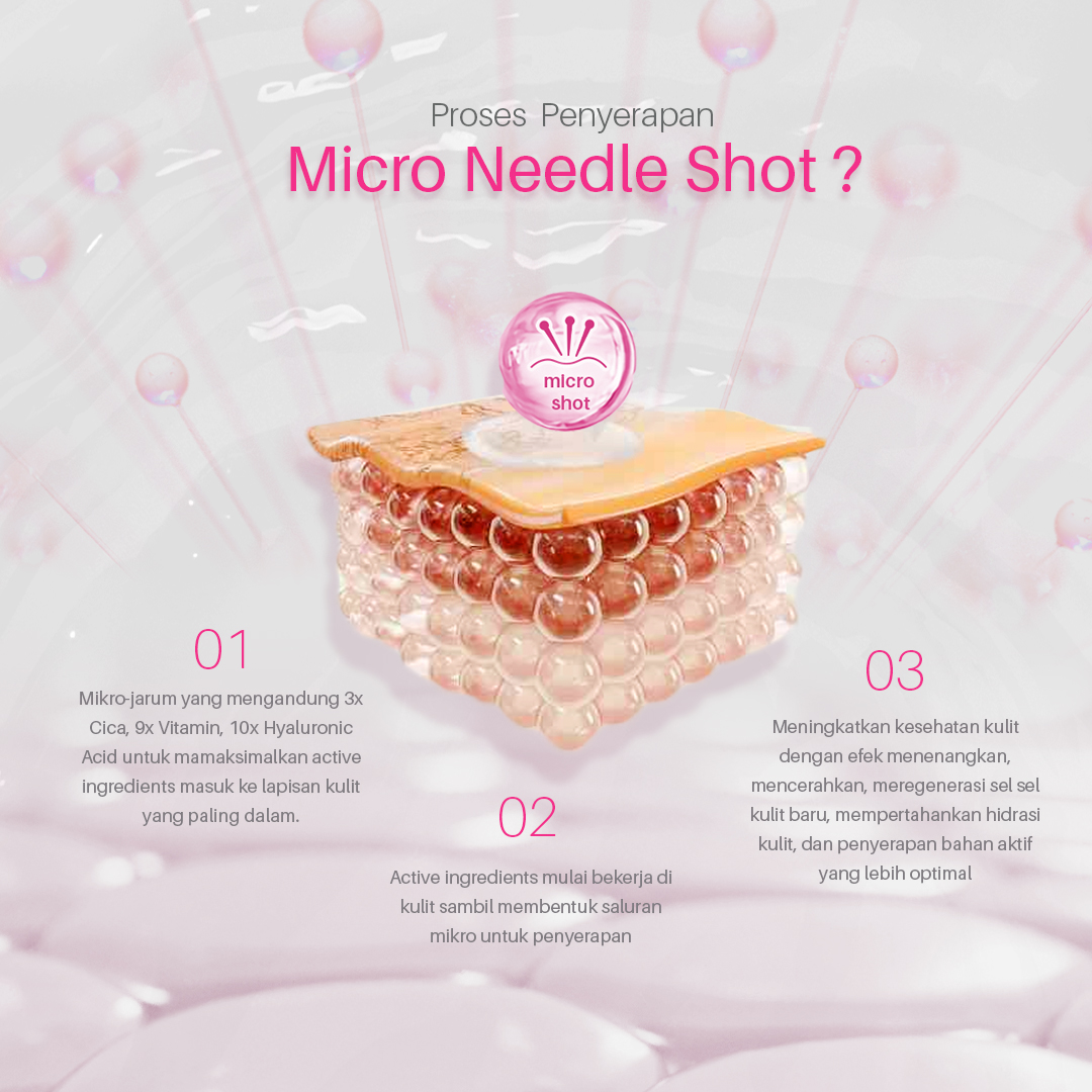 id-11134208-7ra0q-md42bhs4vyd441