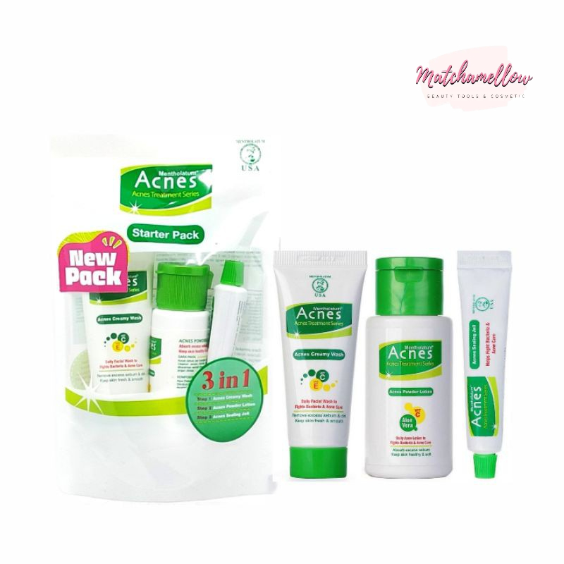 ❄️MATCHA❄️ ACNES STARTER PACK - ACNES TREATMENT SERIES TRAVEL KIT
