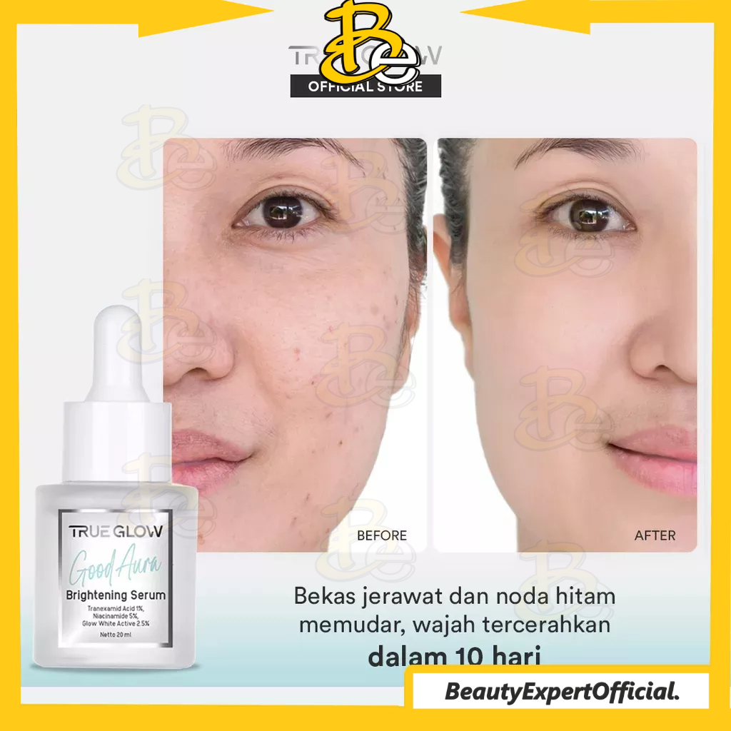 ⭐️ Beauty Expert ⭐️ TRUE GLOW Good Aura Brightening Serum - Serum Cerah Maksimal Untuk Menyamarkan Flek Hitam, Bekas Jerawat/Dark Spot