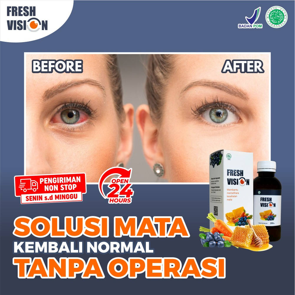 Madu Fresh Vision - Suplemen Madu 100% Original Bantu Atasi Mata Minus Mines Penghlihatan Buram Kabur Mata Mudah Lelah Kemerahan Kering Gatal Cegah Katarak Glukoma